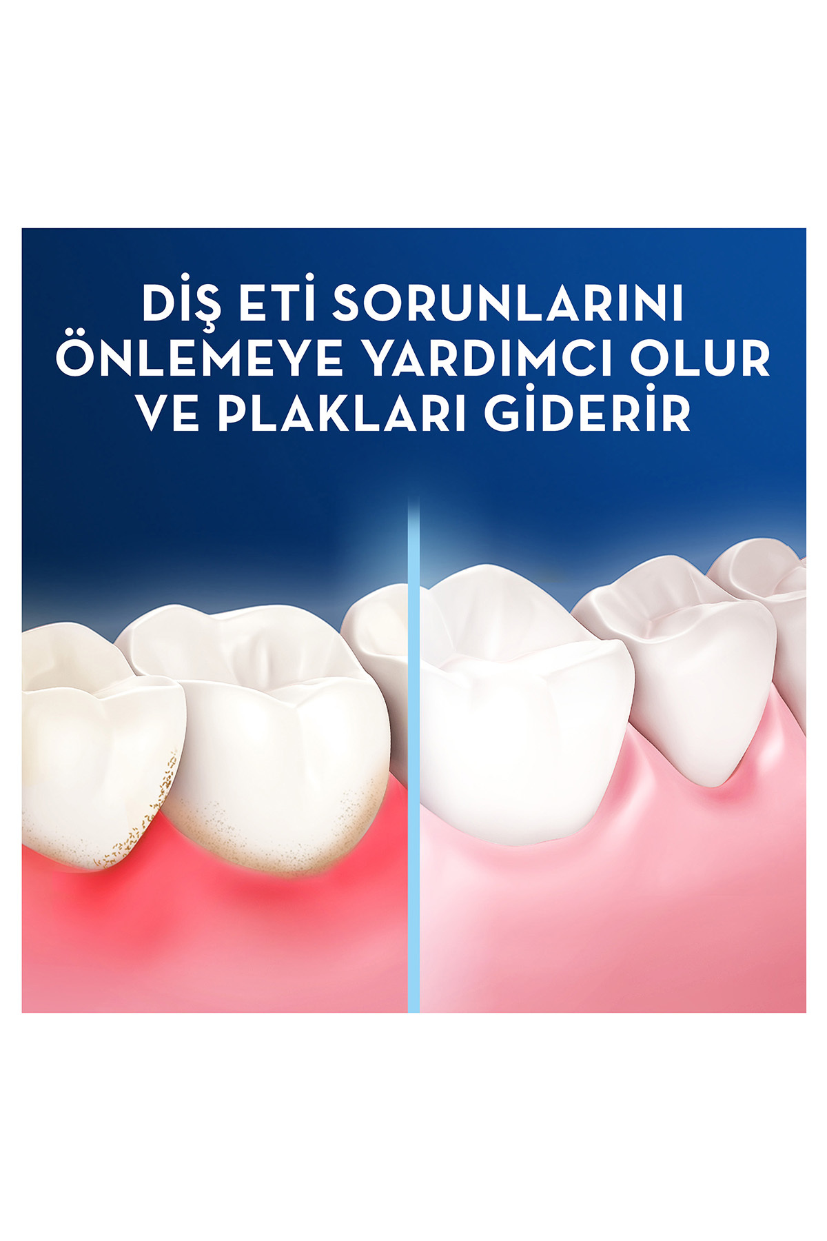 Oral-B Pro Expert Advanced Sağlıklı Diş Etleri 25M-