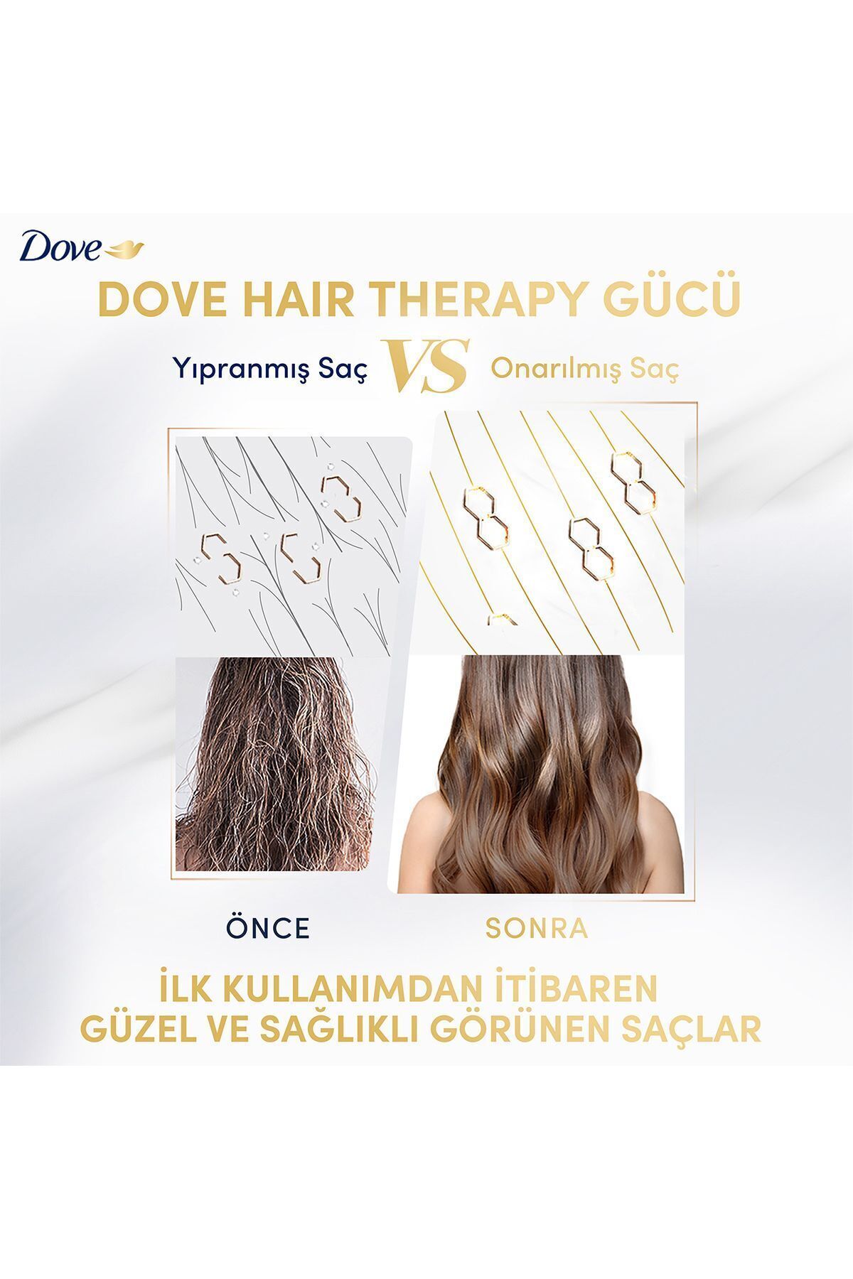 Dove Hair Therapy Breakage Remedy saç kremi-
