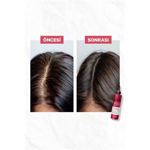 Urban Care No.2 Expert Apple Cider Kepek Karşıtı T-
