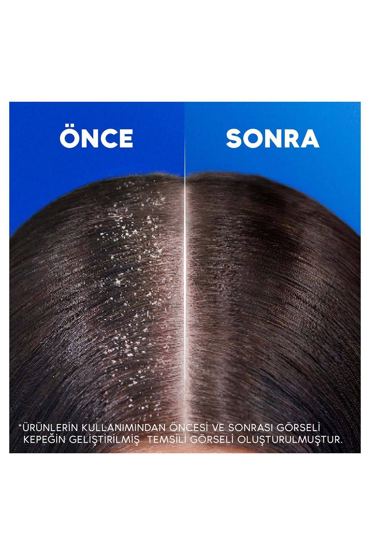 Head And Shoulders Şampuan Kadınlara Özel Saç Dökü-